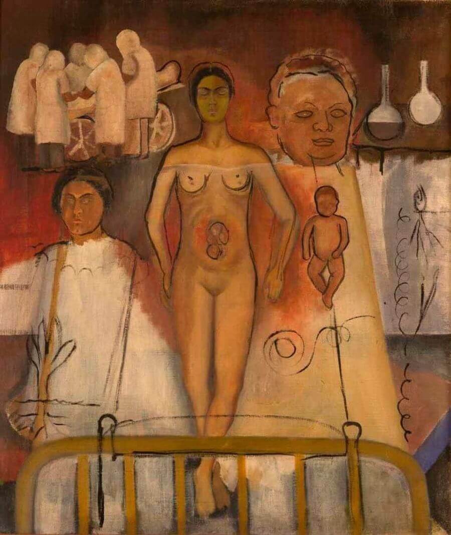 Frida et l’opération césarienne - Frida Kahlo