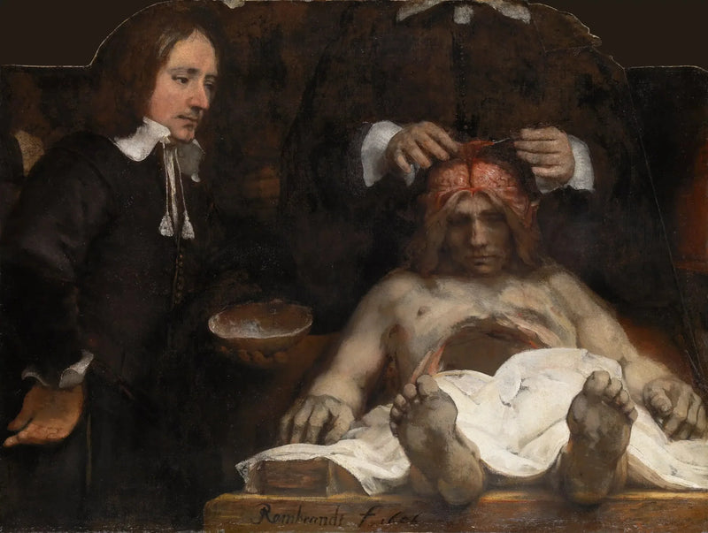 La Lezione di anatomia del Dottor Joan Deyman - Rembrandt